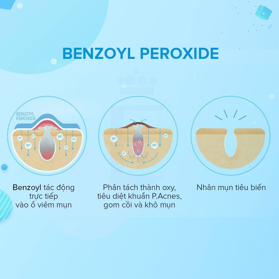Benzoyl peroxide được dùng nhiều trong các sản phẩm trị mụn sưng viêm, mụn bọc!