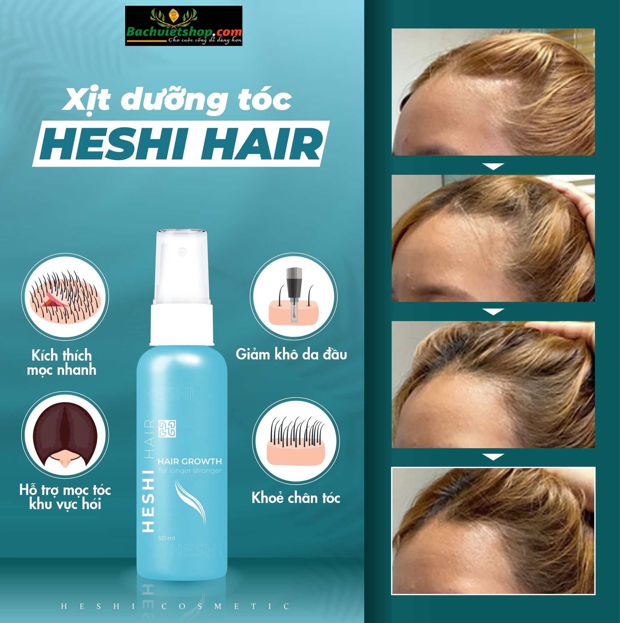 F5 ngay mái tóc của bạn với Xịt dưỡng tóc Heshi Hair Growth ngay từ bây giờ nhé!